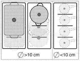 Beko HII68600PTB zone combin�e